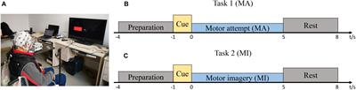 The Differences Between Motor Attempt and Motor Imagery in Brain-Computer Interface Accuracy and Event-Related Desynchronization of Patients With Hemiplegia